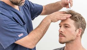 When Hair Loss is Normal and When to worry about it